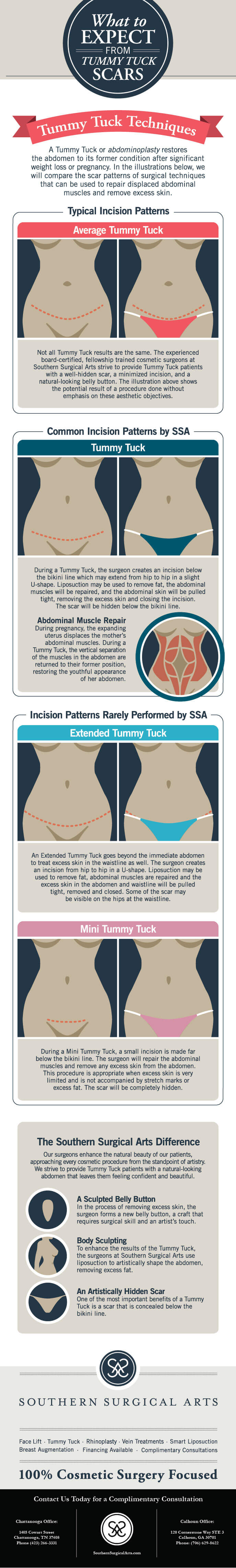 Do Tummy Tucks leave scars? Busting Abdominoplasty Myths