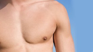 Causes of Gynecomastia