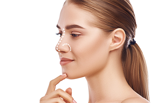 Rhinoplasty